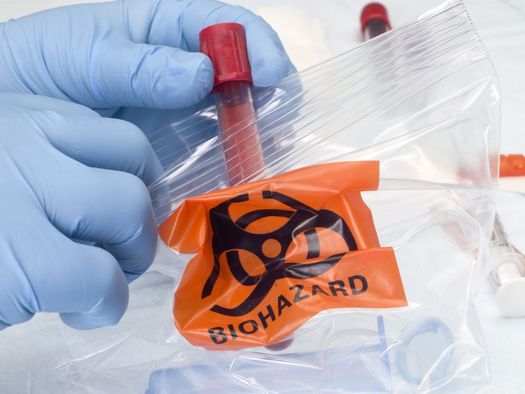 An image of someone bagging up blood samples.